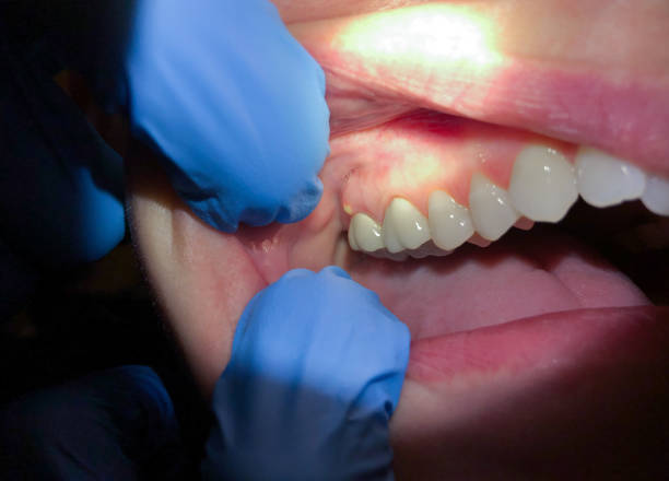 Best Emergency Treatment for Jaw Pain or Injury in Haslet, TX