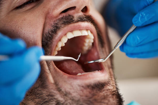 Best Broken or Chipped Tooth Repair in Haslet, TX